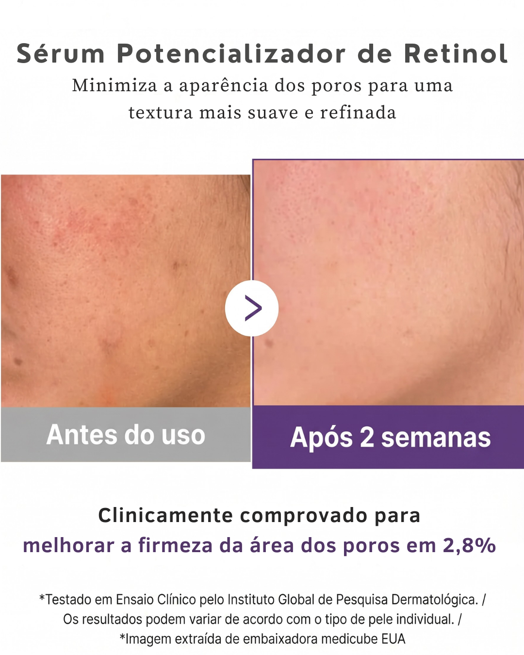 Medicube Retinol NMN Boosting Serum 30 ml – Sérum Facial Antiedad Reafirmante
