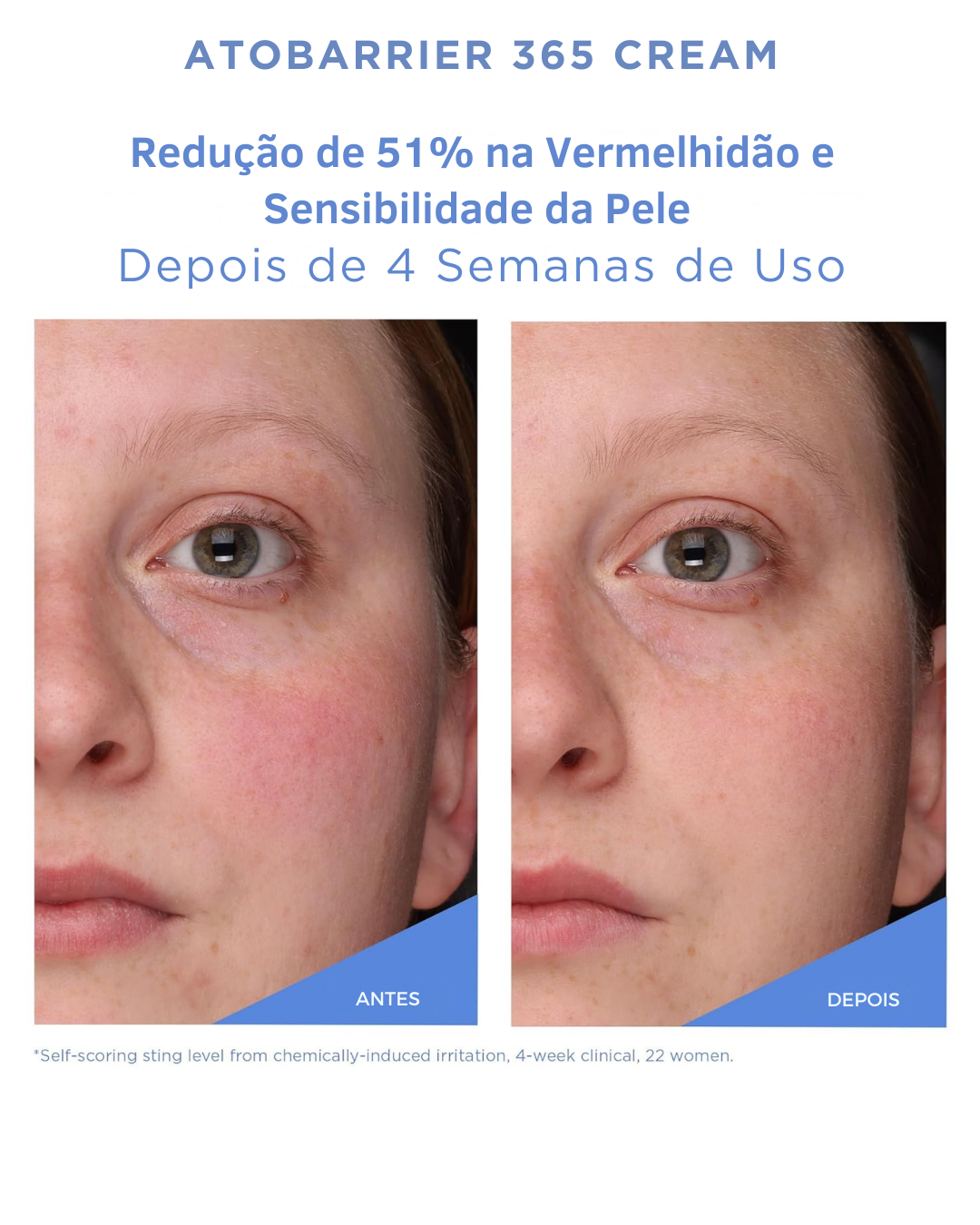AESTURA ATOBARRIER365 – Crema Hidratante con Ceramidas para el Rostro, Hidratación Prolongada por 120 h, para Piel Sensible y Reseca, No Comedogénica