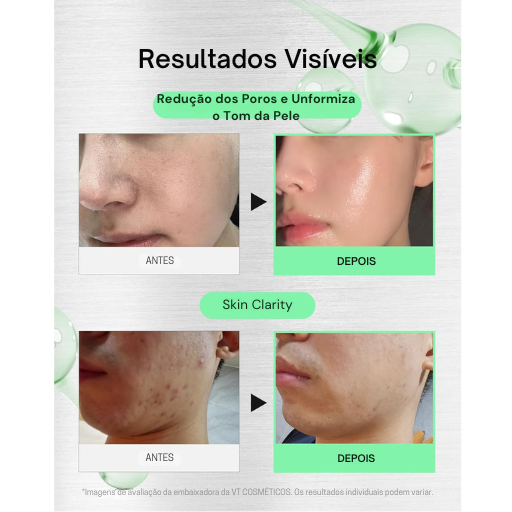 VT COSMETICS CICA Reedle Shot 700 – Sérum de Microagujas en Crema con Espículas y Exosomas