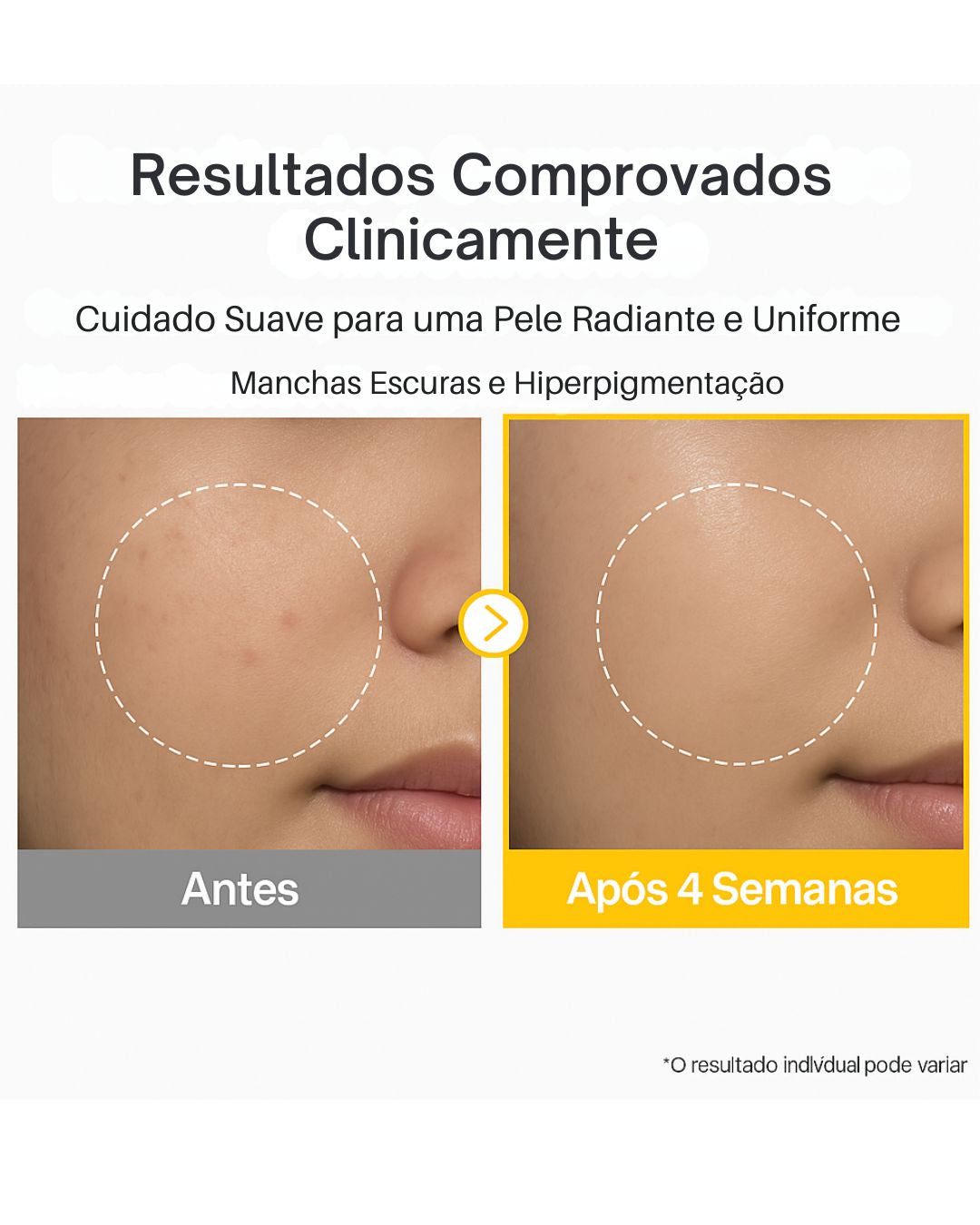 Numbuzin No. 5 Vitamin Concentrated Serum – Adiós a las Manchas y la Opacidad