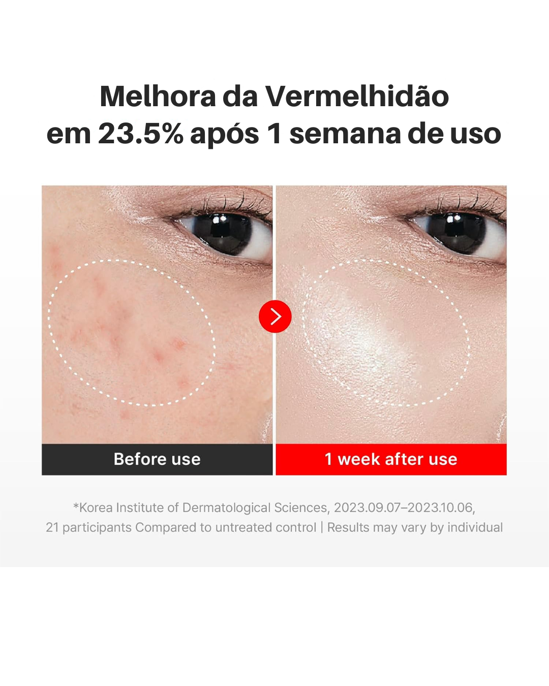 ✨ Crema Rejuvenecedora CENTELLIAN 24 Madeca Time Reverse con Efecto Lifting – Nutre, Hidrata y Reafirma ✨